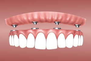 Информация за избелване на зъби 32