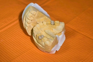 Намерете най-добрите оферти за пародонтоза 13 от MedicalDent Намерете най-добрите оферти за пародонтоза 13