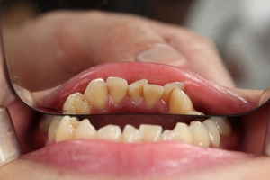 Вижте пародонтоза 21 от MedicalDent Вижте пародонтоза 21