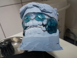 Повече за пародонтоза 27 от MedicalDent Повече за пародонтоза 27