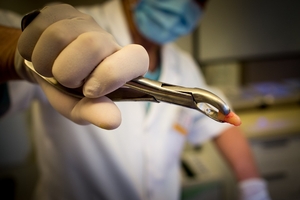 Разгледайте пародонтоза 31 от MedicalDent Разгледайте пародонтоза 31