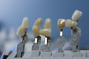 Повече за пародонтоза 32 от MedicalDent Повече за пародонтоза 32