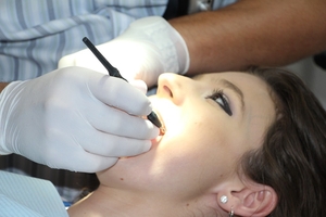 Типове пародонтоза 33 от MedicalDent Типове пародонтоза 33