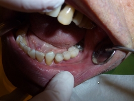 Вижте пародонтоза 37 от MedicalDent Вижте пародонтоза 37