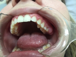 Намерете най-добрите оферти за пародонтоза 39 от MedicalDent Намерете най-добрите оферти за пародонтоза 39