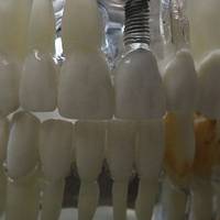 Типове зъболекар софия 3