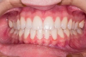 пасти за зъби без флуор - 68585 постижения