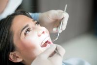 брекети цени - 13773 вида | Dentalcare брекети цени - 9331 вида