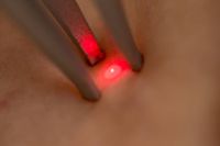център за лазерна епилация - 98865 отстъпки | Abibeauty център за лазерна епилация - 99401 отстъпки