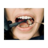 плазмолифтинг - 87819 предложения | Dental Club плазмолифтинг - 18830 предложения
