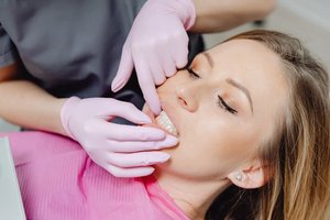 изграждане на счупен зъб цена - 28663 комбинации