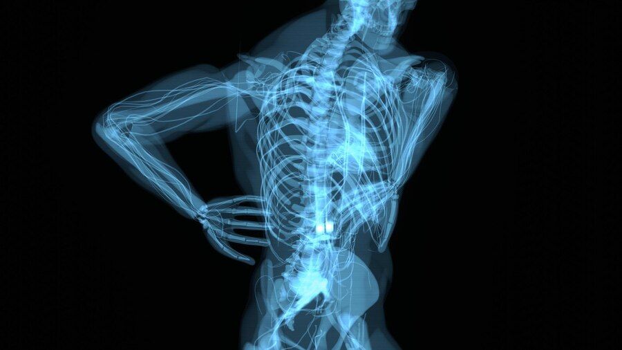 болки в тазобедрената става - 78545 клиенти | osteostrong.bg болки в тазобедрената става - 25689 клиенти
